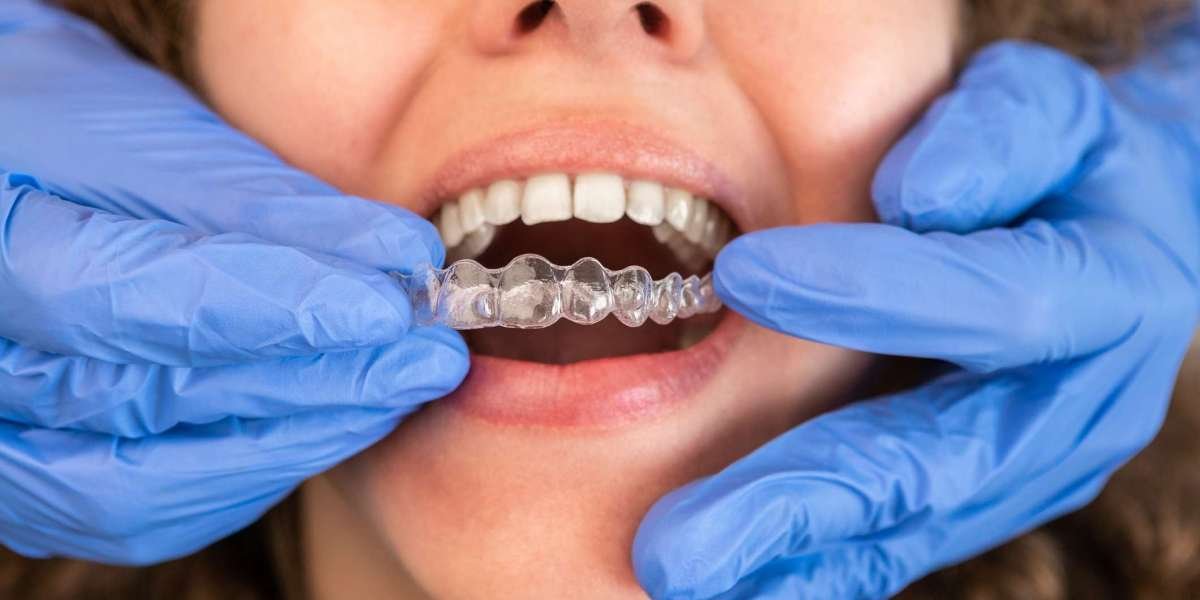 Invisalign: Your Path to a Sleeker, Straighter Smile