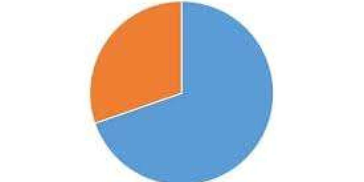 Qatar Jewelry Market Trends to Watch: Growth, Share, Segments and Forecast Data