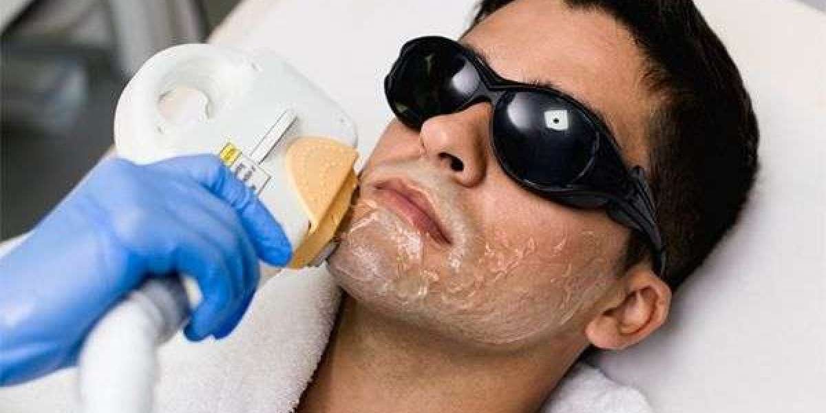Smooth and Confident: Your Guide to Laser Hair Removal in Islamabad